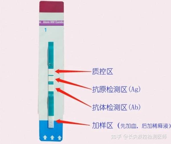 艾滋病第四代检测是抽血吗 艾滋病第四代检测是抽血吗