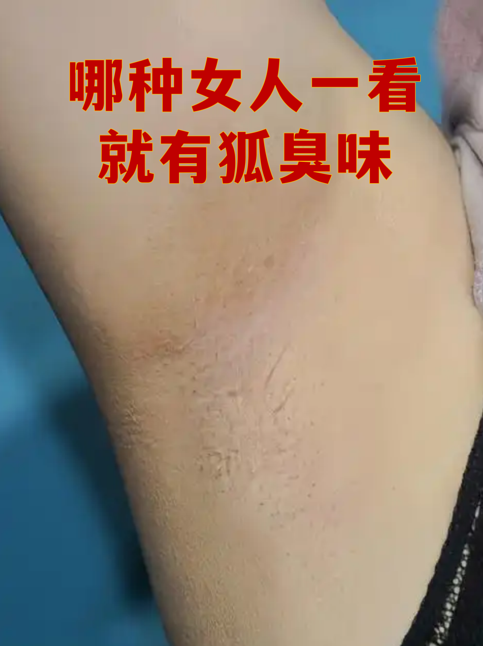 男生有狐臭吗 男生有狐臭吗