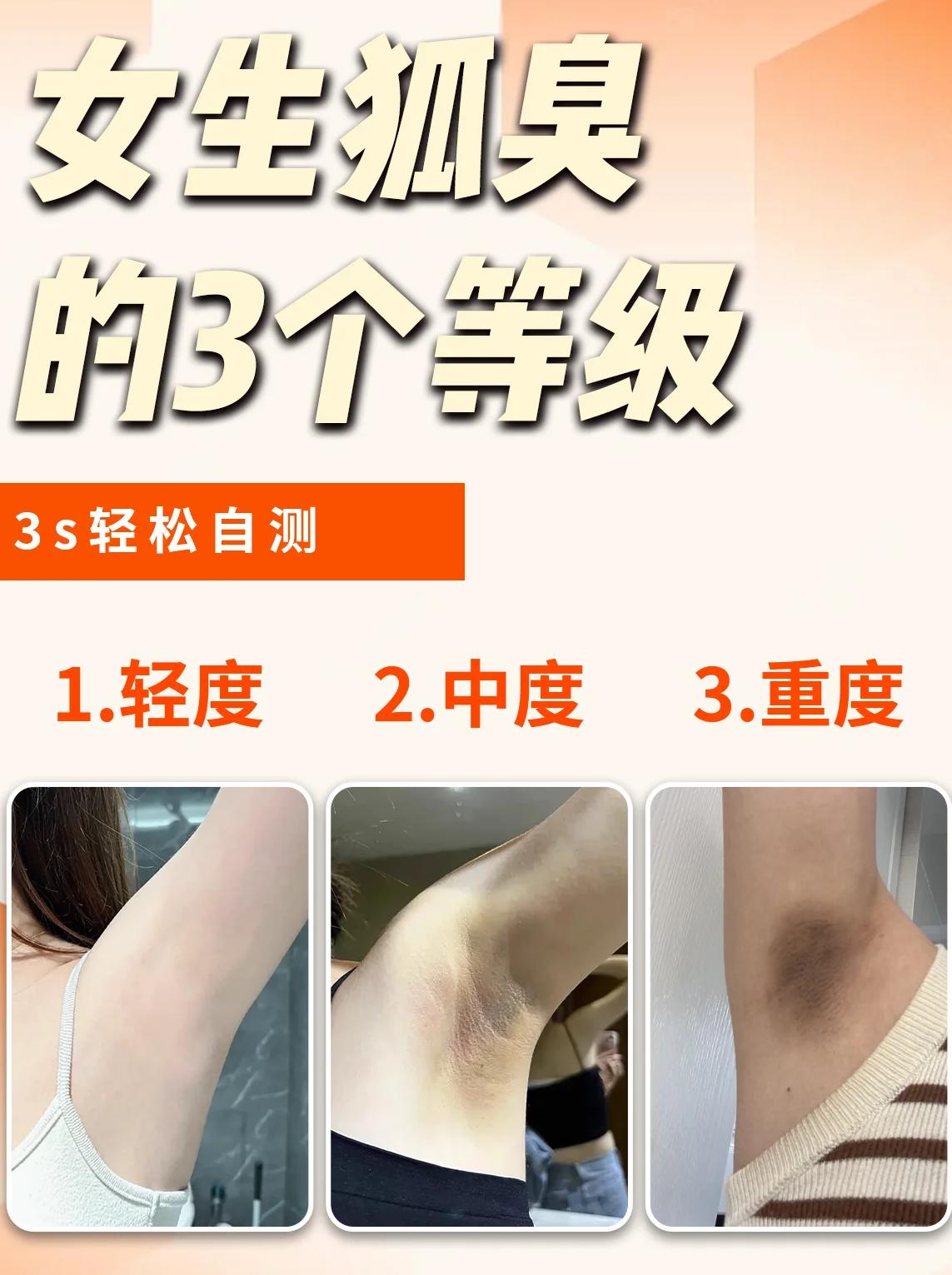 狐臭和腋臭有什么区别怎样治疗