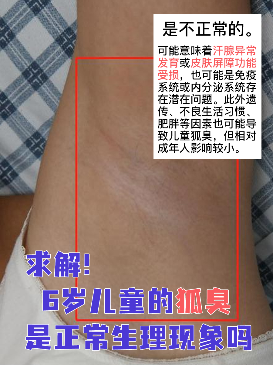 腋臭和狐臭有什么区别怎么辨别