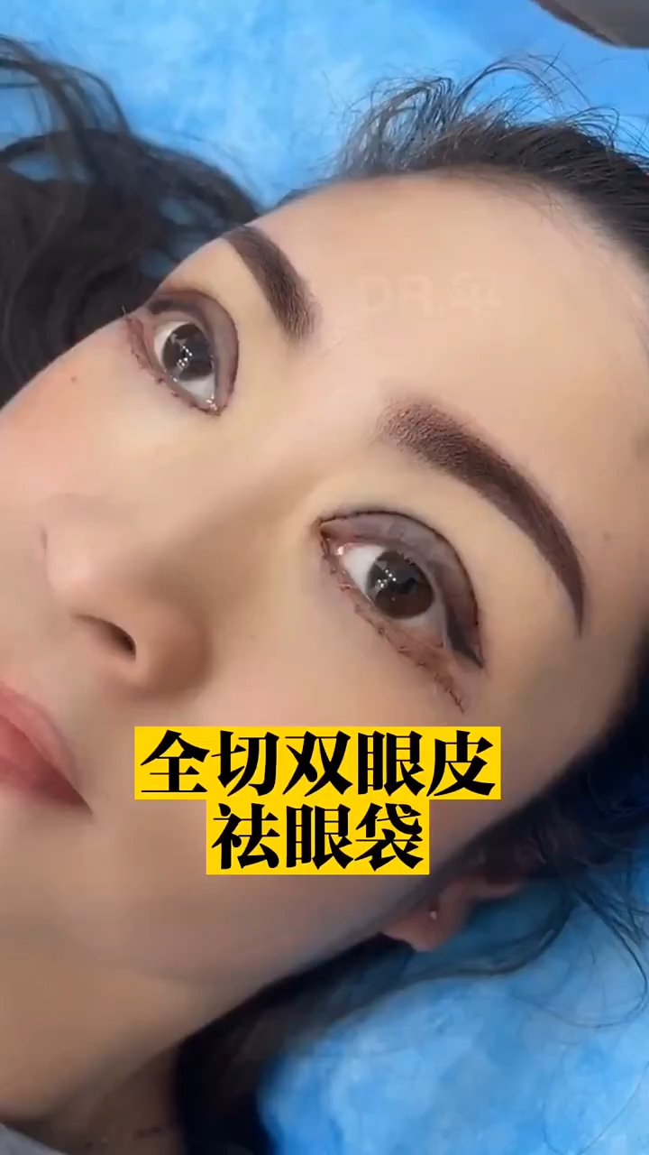 风水学解说割双眼皮