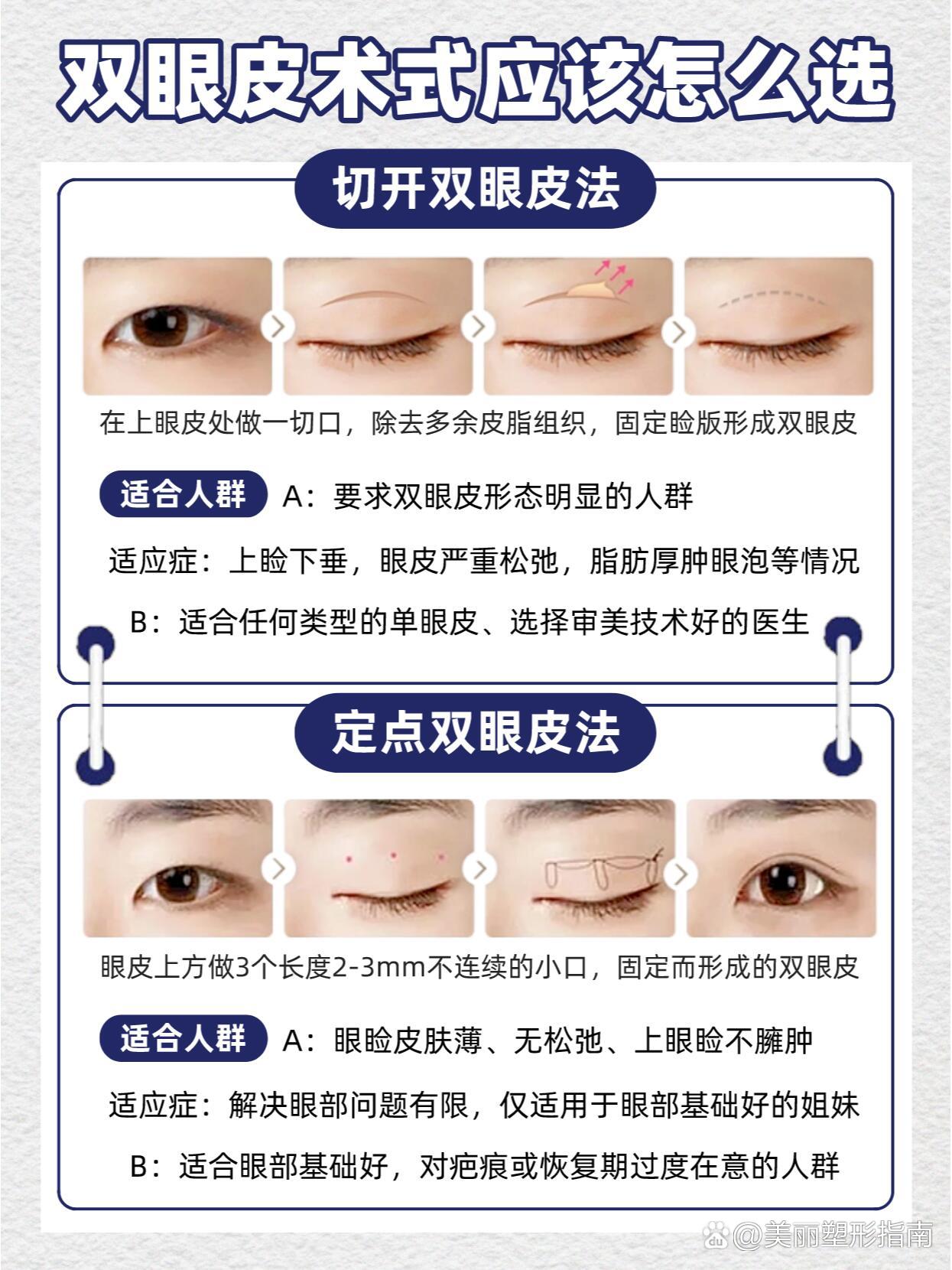 风水学解说割双眼皮 风水学解说割双眼皮