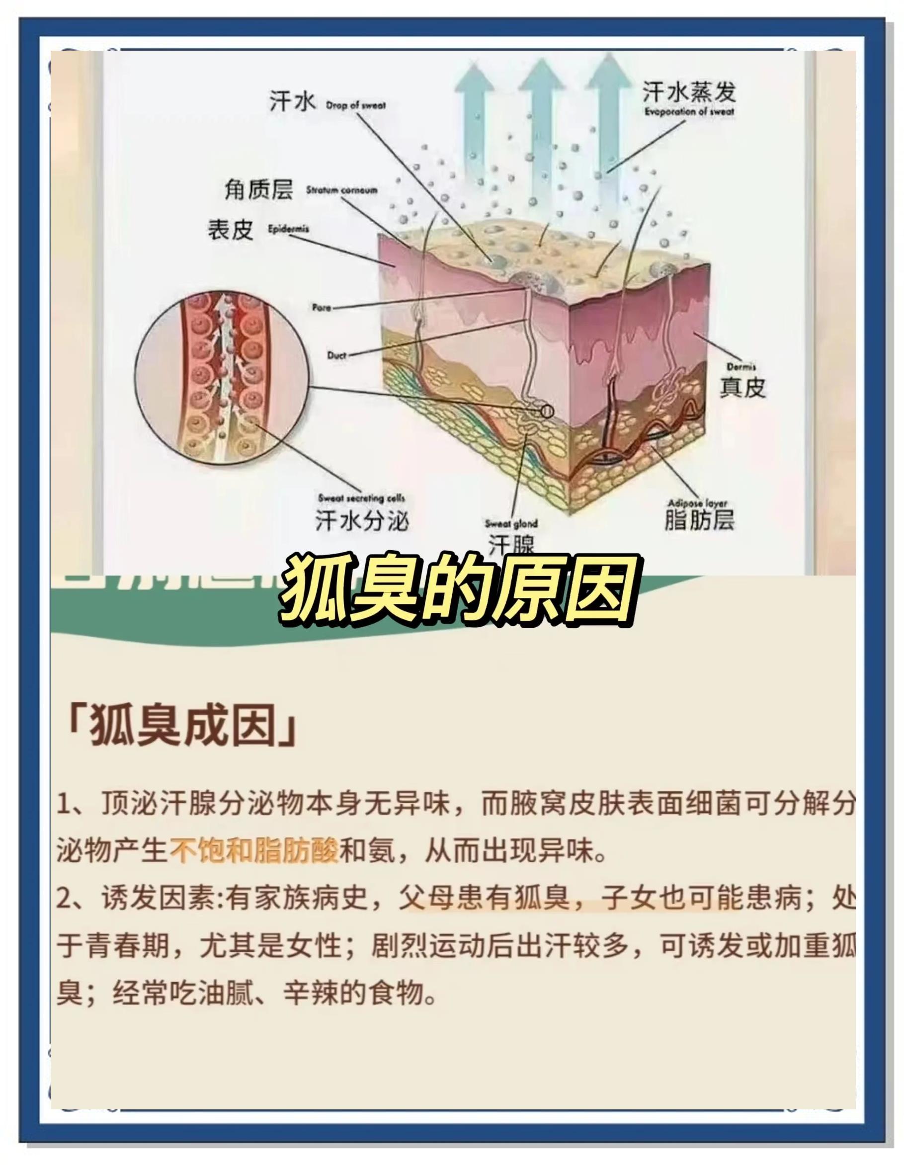 狐臭的人有什么特征