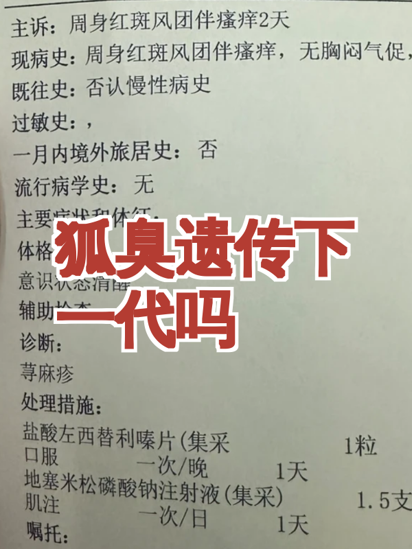 狐臭遗传会代代减轻吗 狐臭遗传会代代减轻吗