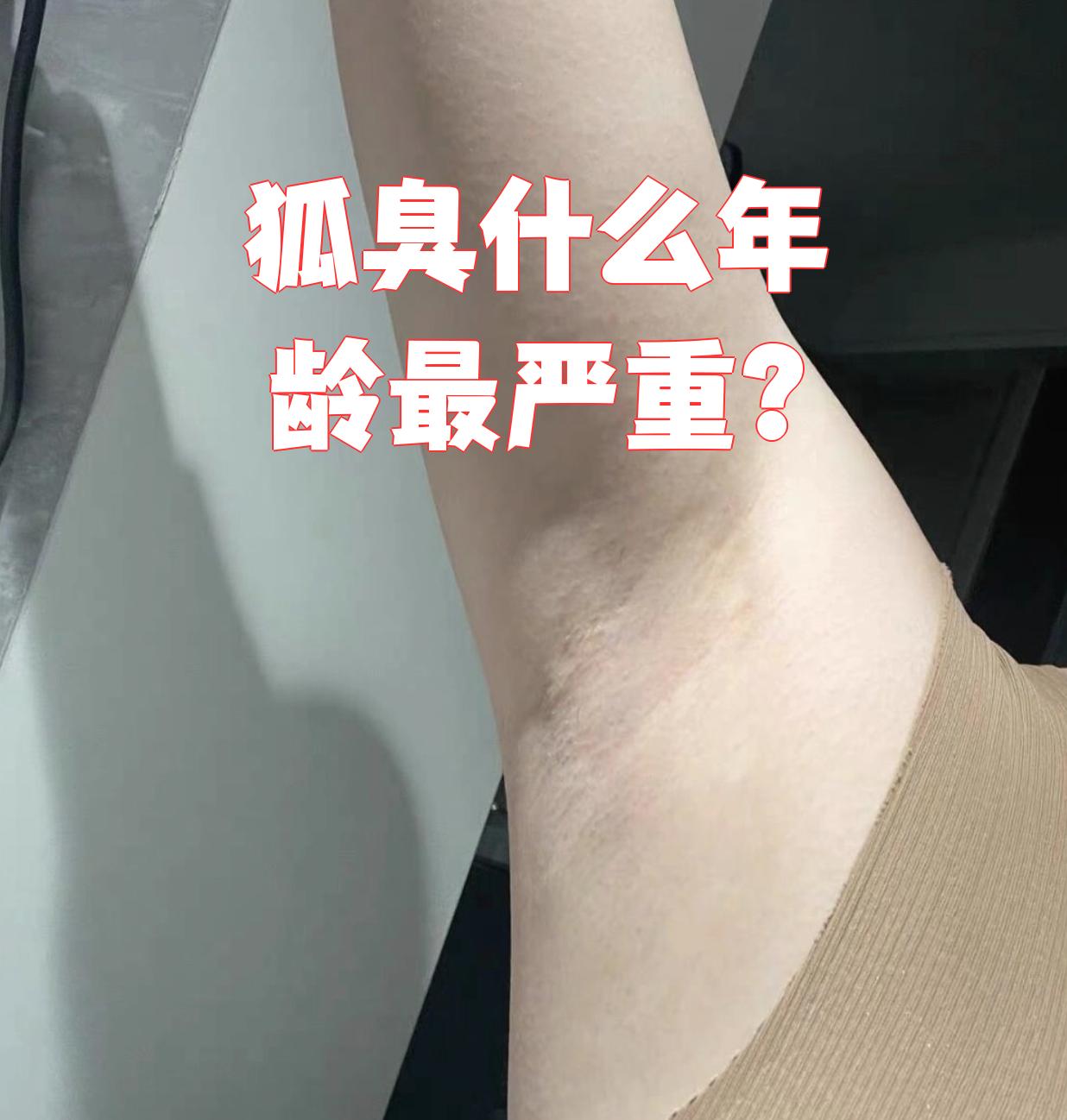 狐臭什么时候味道最大 狐臭什么时候味道最大