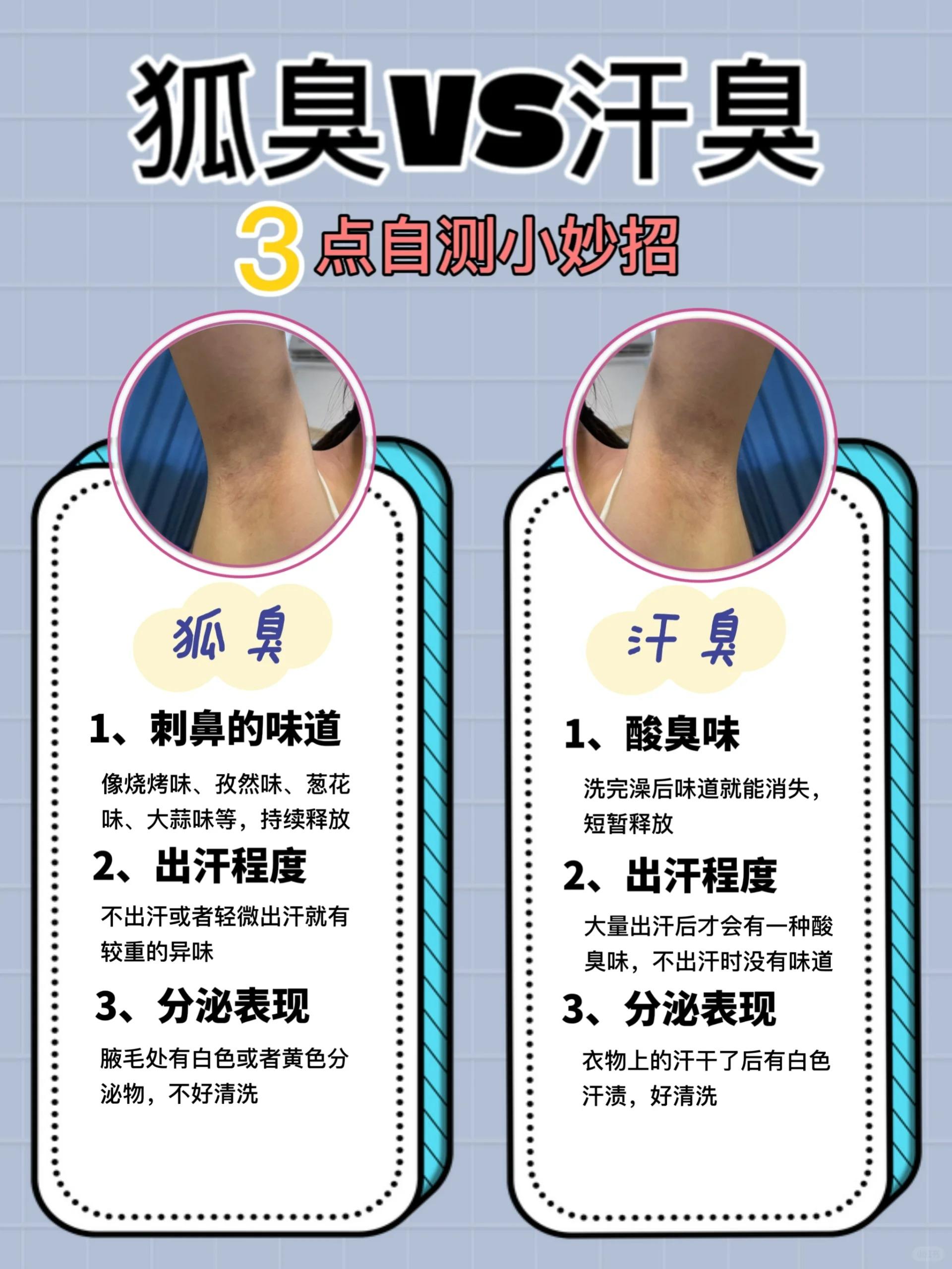 狐臭一般遗传几代人 狐臭一般遗传几代人