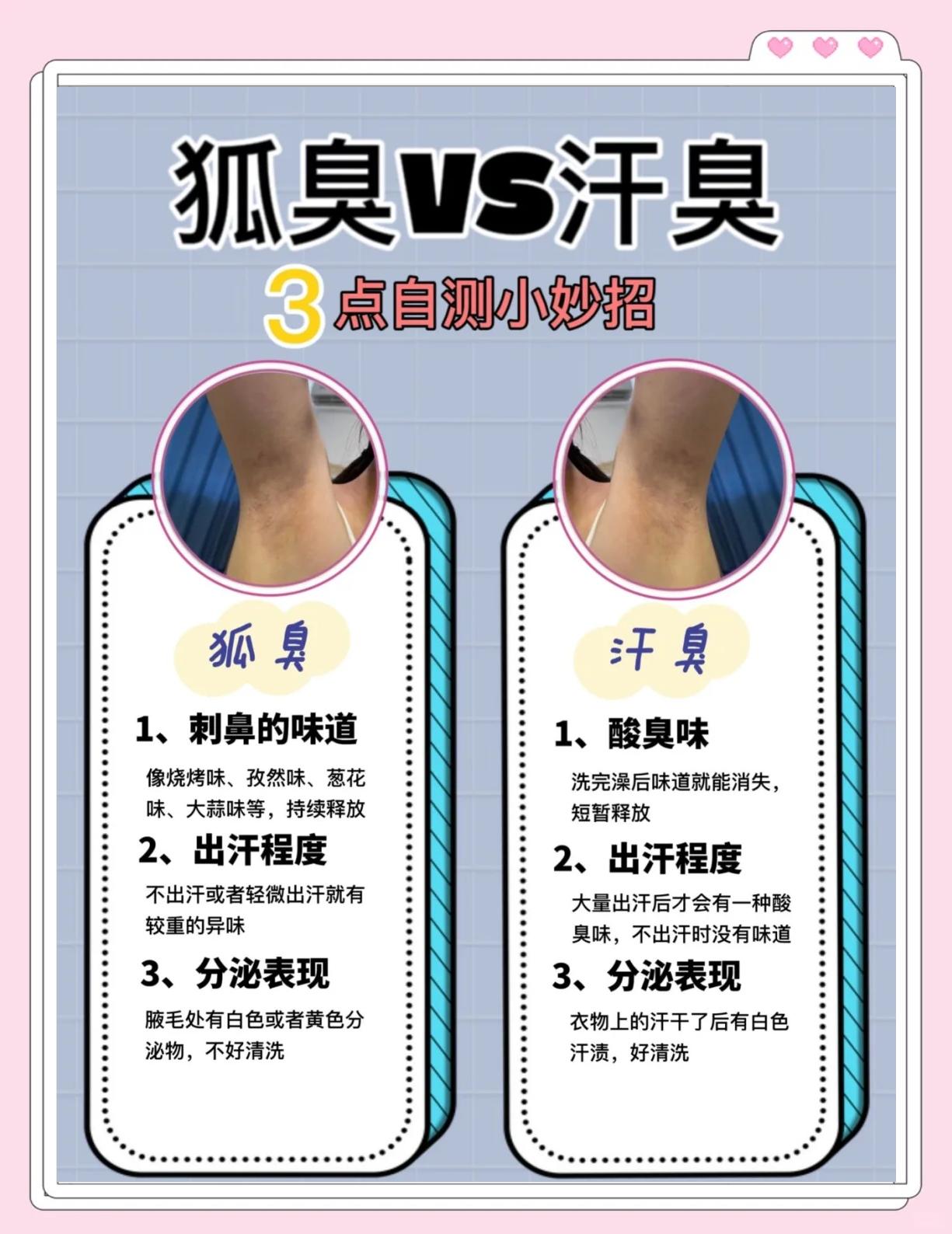 狐臭代表什么意思 狐臭代表什么意思