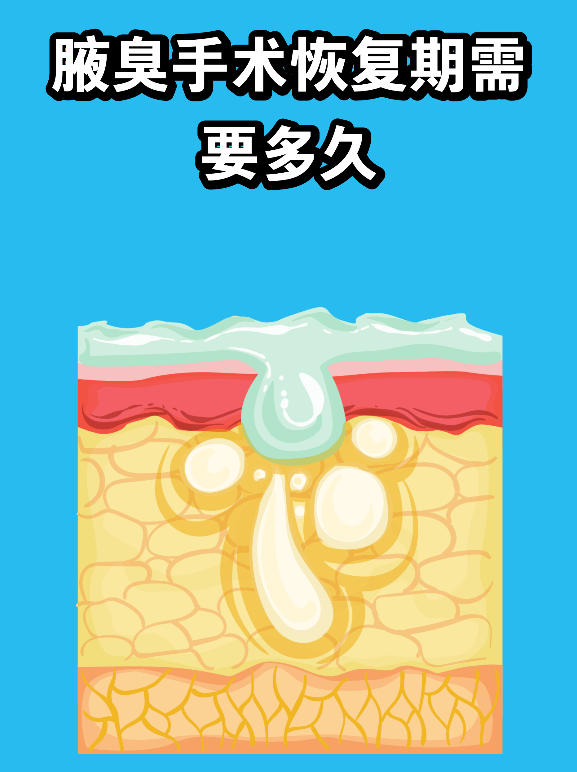 腋臭手术有副作用吗