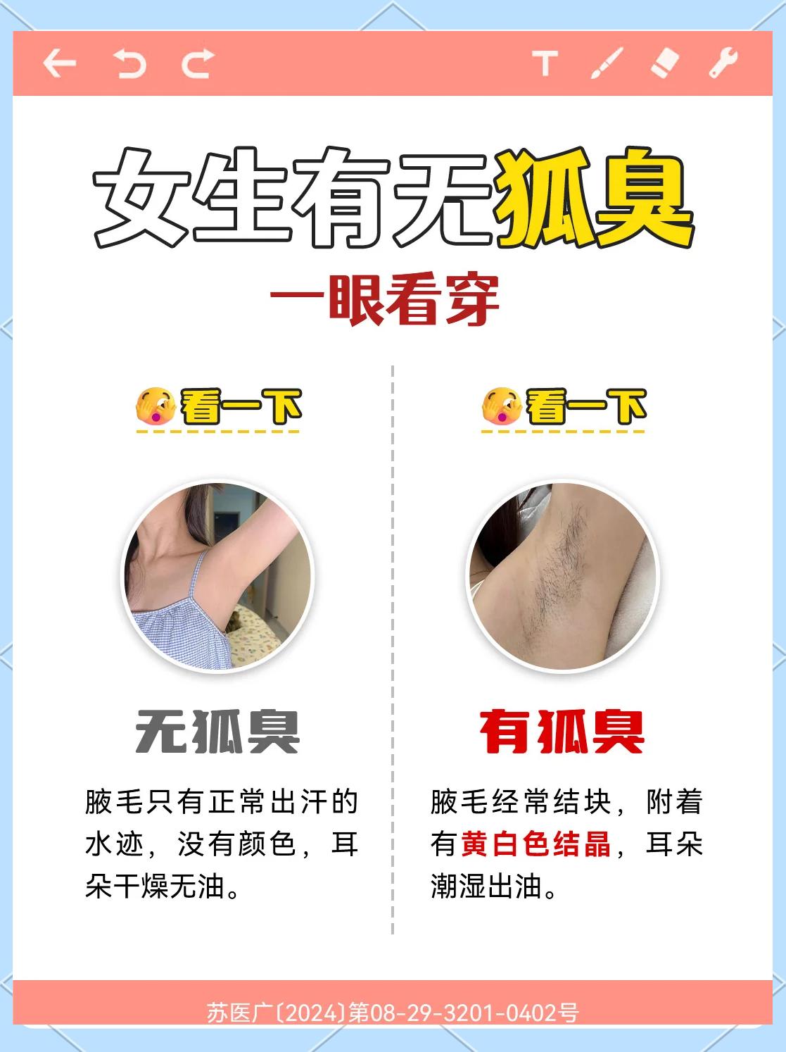 后天性狐臭会遗传吗(不是遗传的狐臭会好起来吗) 后天性狐臭会遗传吗(不是遗传的狐臭会好起来吗)