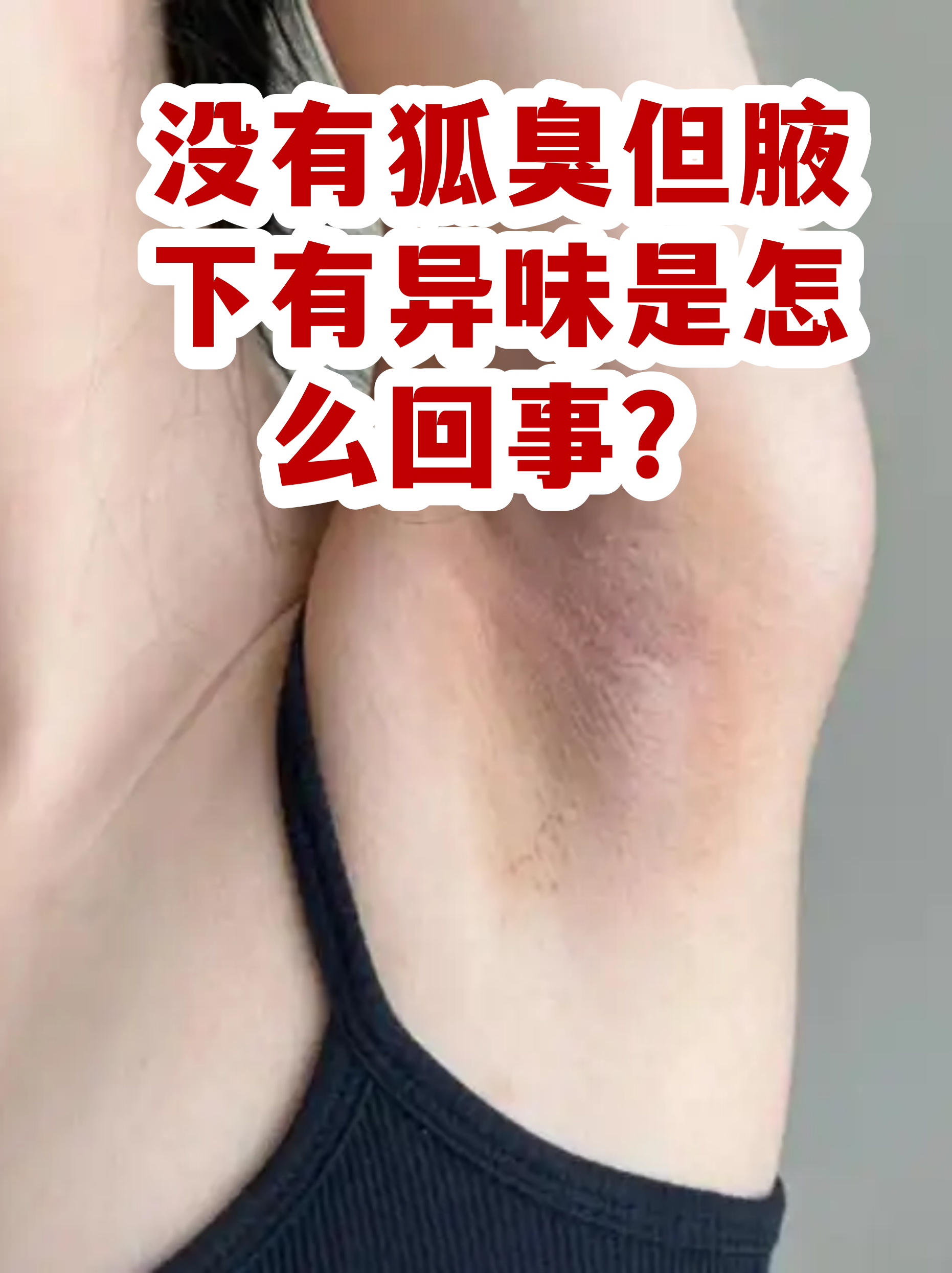 狐臭没有遗传会突然出现吗(家里没有狐臭遗传 孩子怎么突然会有)