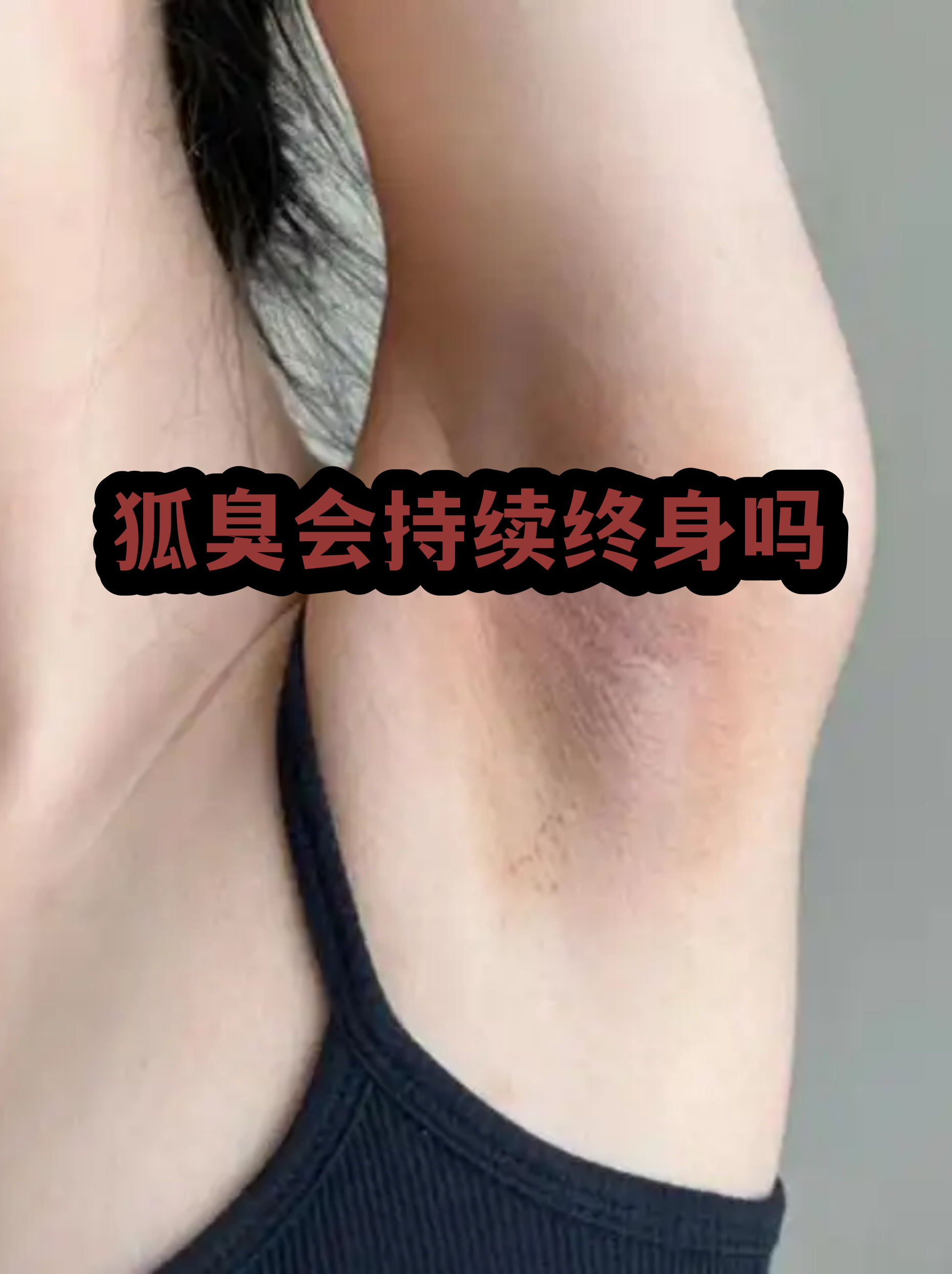 狐臭为什么要叫狐臭(狐臭为什么要叫狐臭呢)
