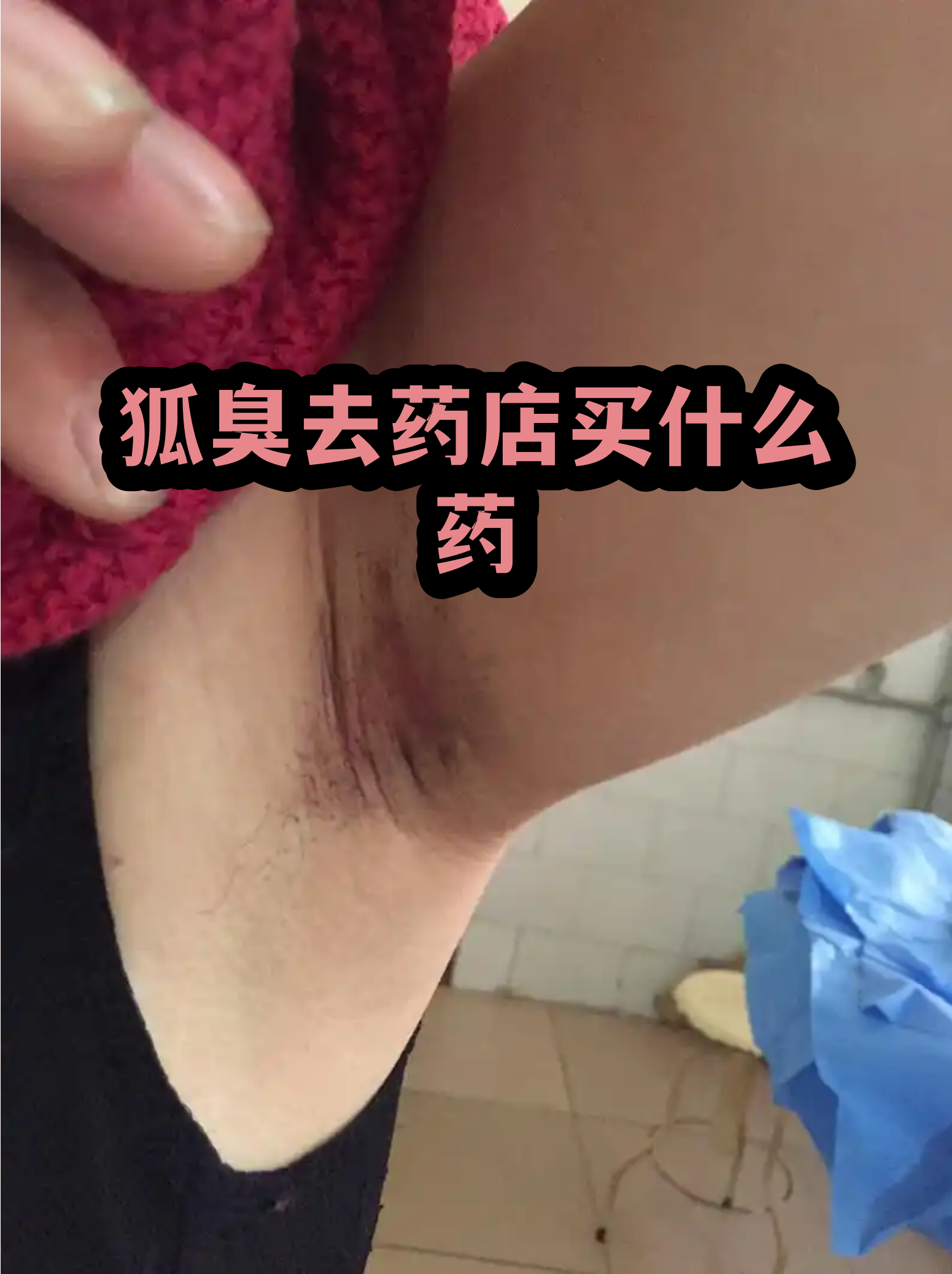 狐臭去药店买什么药(小孩子有狐臭怎么办才能根除)