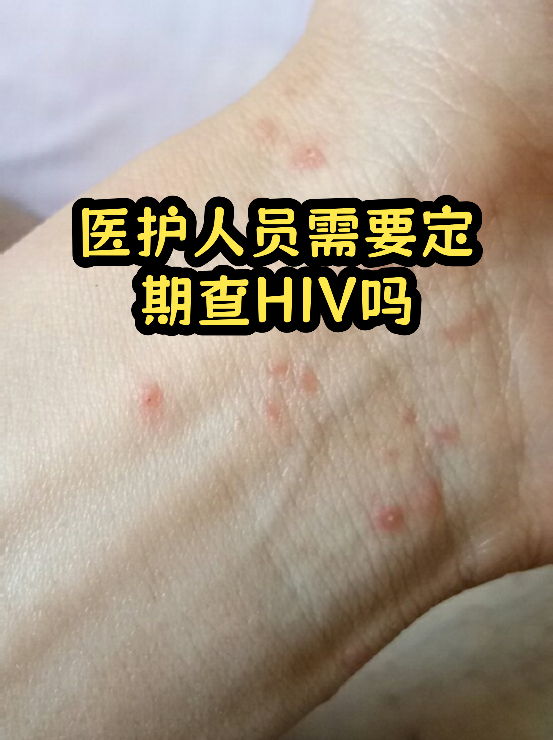 HIV第四代检测最迟完全排除(艾滋病第四代检测能查出hiv2型吗)