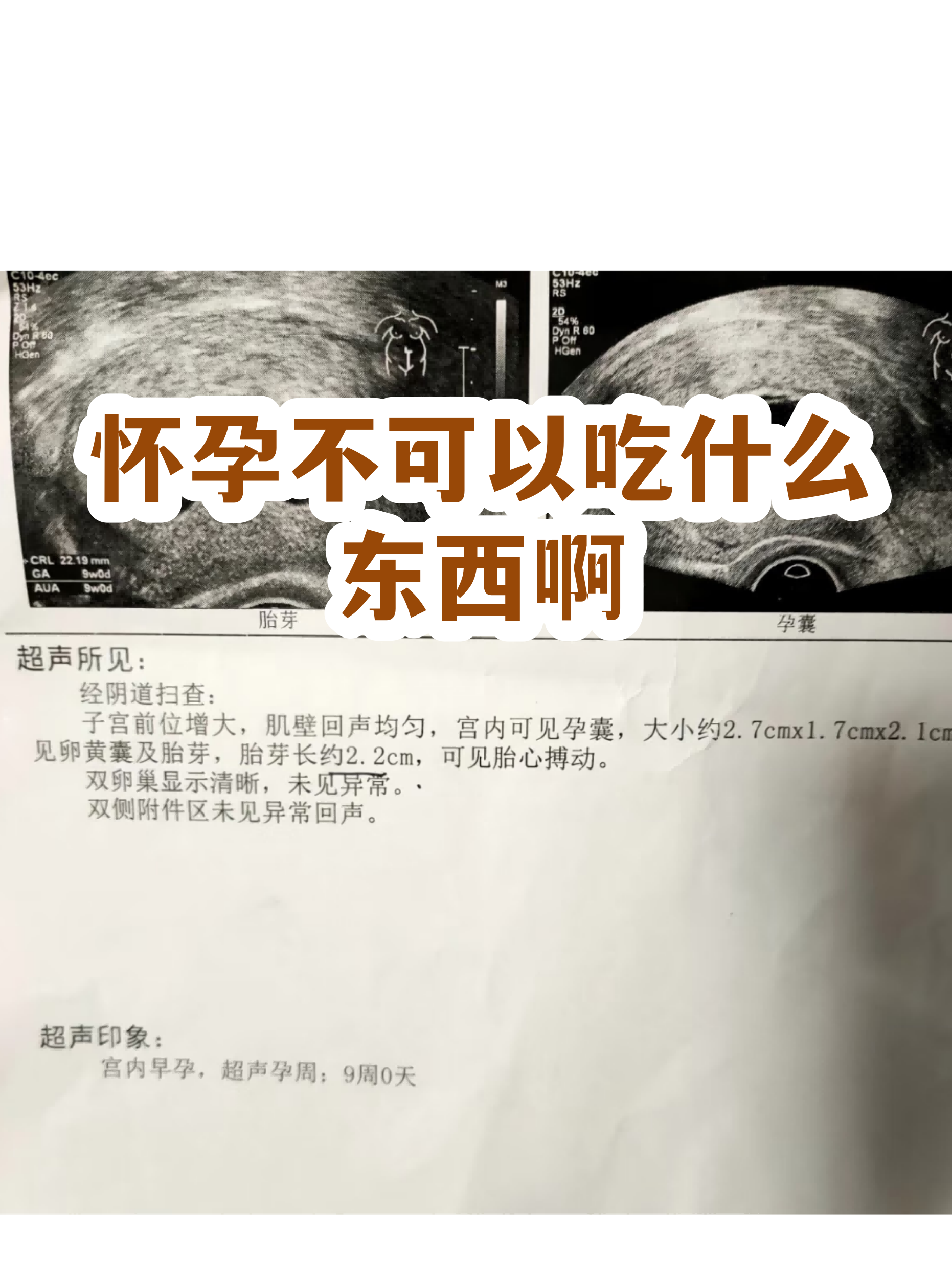 吃什么食物不容易怀孕(吃啥不怀孕还不会伤身体)