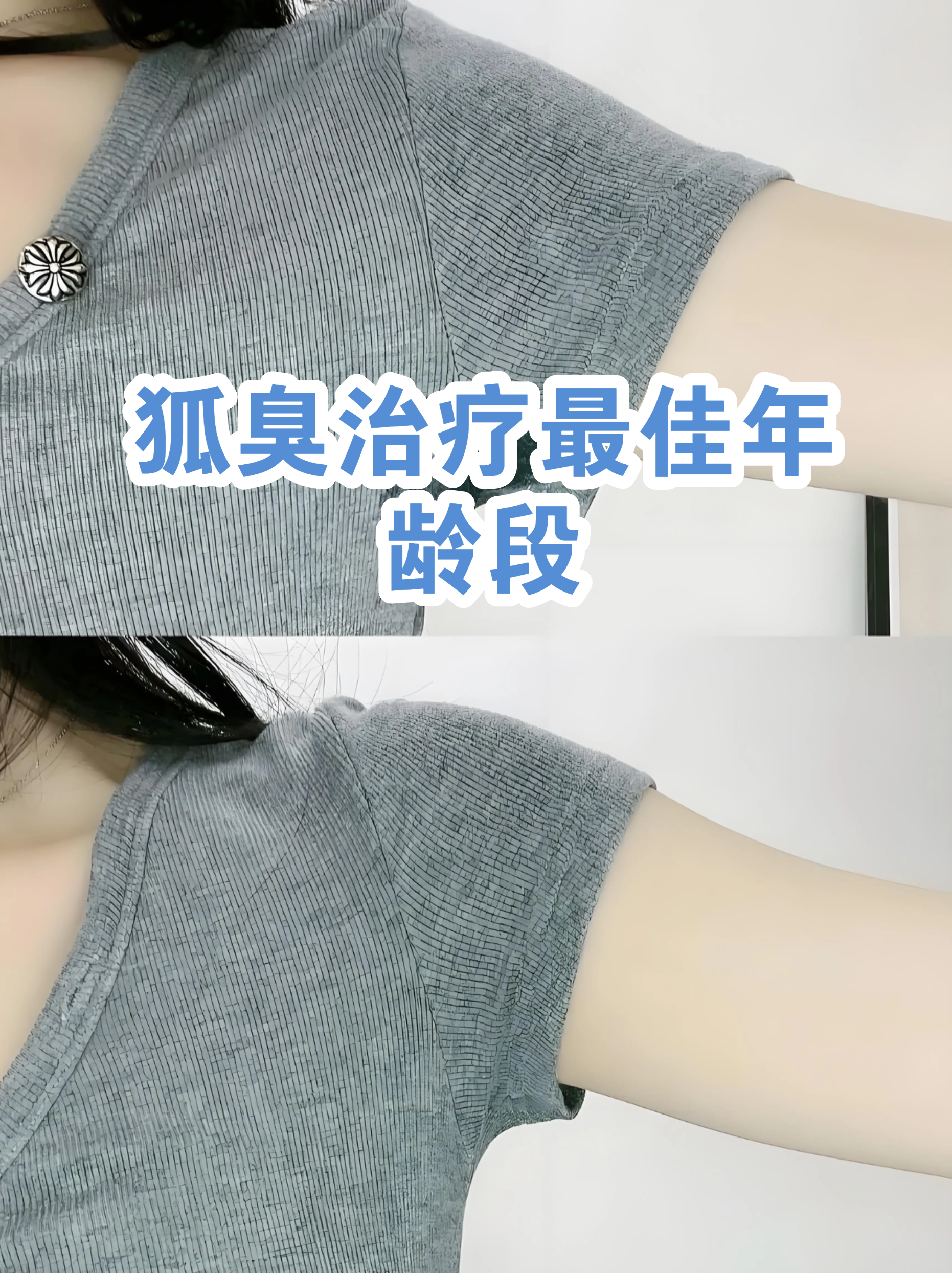 儿童做狐臭手术的最佳年龄(儿童狐臭手术最佳年龄做微创) 儿童做狐臭手术的最佳年龄(儿童狐臭手术最佳年龄做微创)