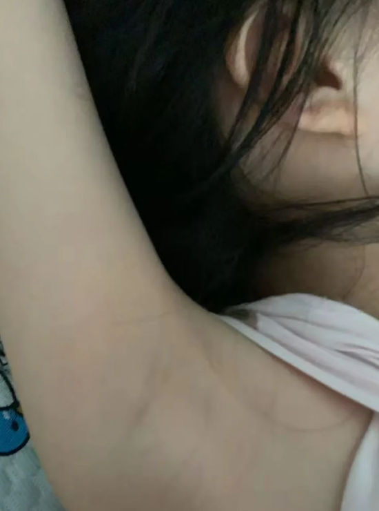 青春期假性狐臭多久会消失的简单介绍