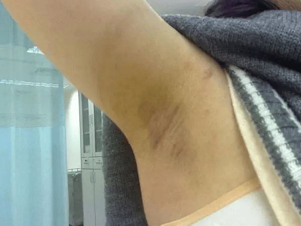 有狐臭的女人身体那里不好(有狐臭的女人身体那里不好怎么办)
