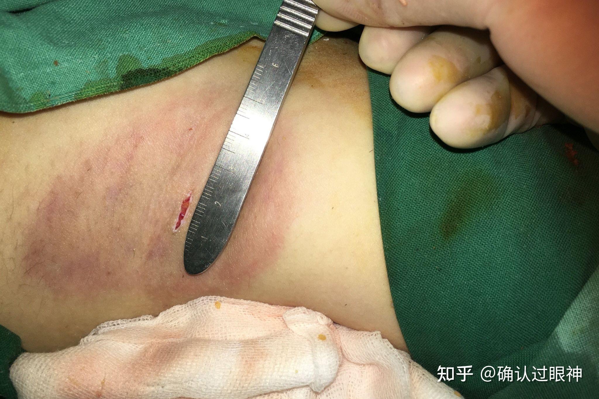 狐臭的人是动物转世吗知乎的简单介绍