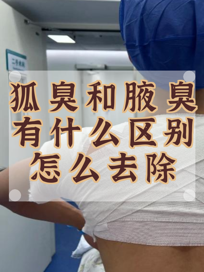 有狐臭代表什么(有狐臭要注意什么) 有狐臭代表什么(有狐臭要注意什么)