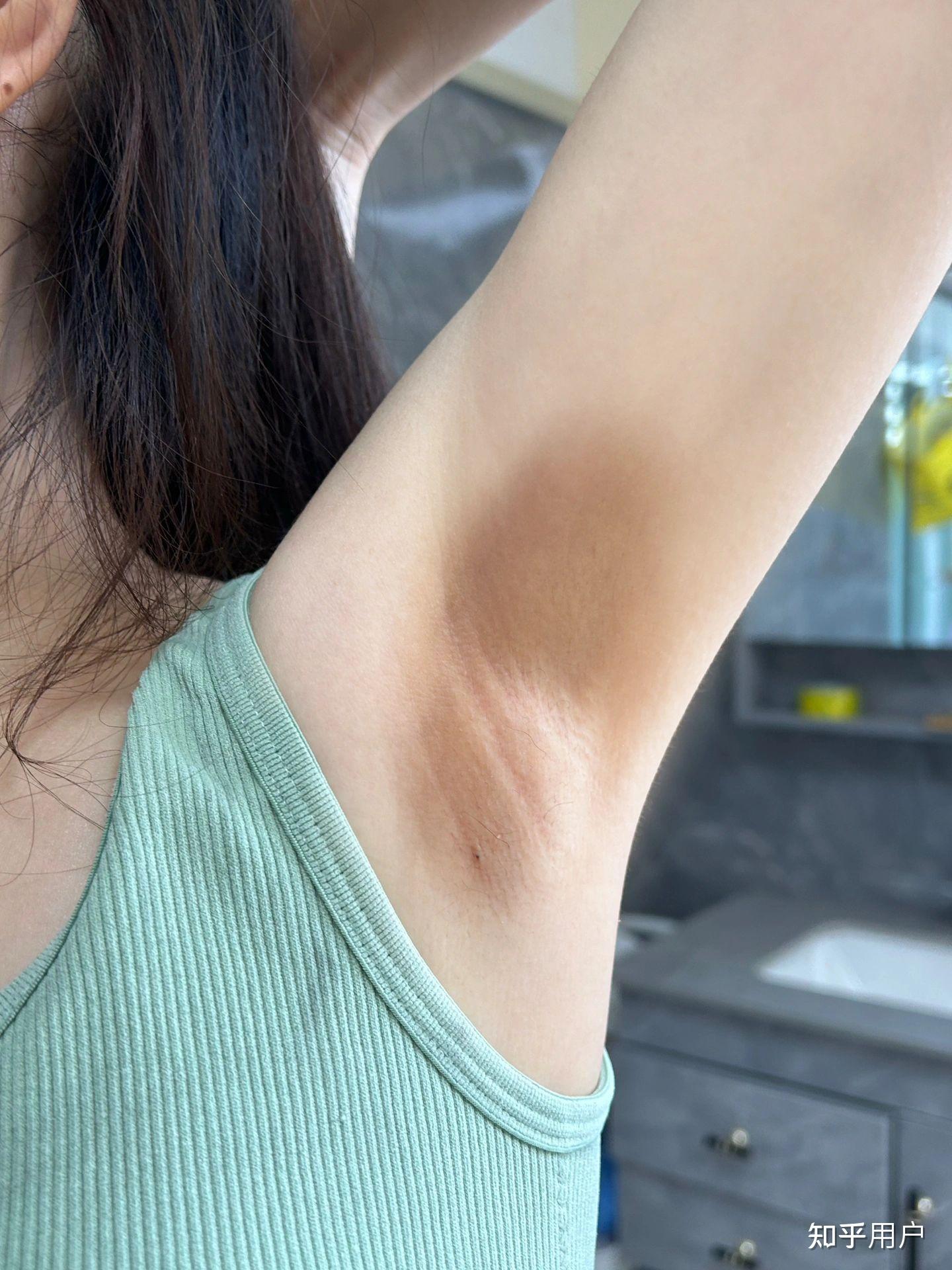 有狐臭的女孩子漂亮吗(有狐臭的人一般都长的漂亮吗) 有狐臭的女孩子漂亮吗(有狐臭的人一般都长的漂亮吗)