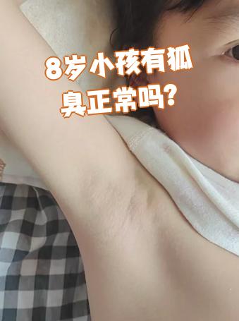 有狐臭的人有福气吗图片(有狐臭的人是命运不好吗为什么) 有狐臭的人有福气吗图片(有狐臭的人是命运不好吗为什么)