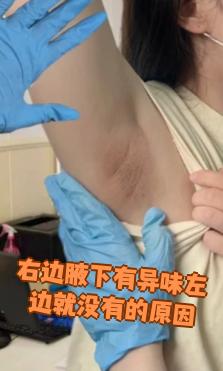 有狐臭的人有福气吗图片(有狐臭的人是命运不好吗为什么) 有狐臭的人有福气吗图片(有狐臭的人是命运不好吗为什么)