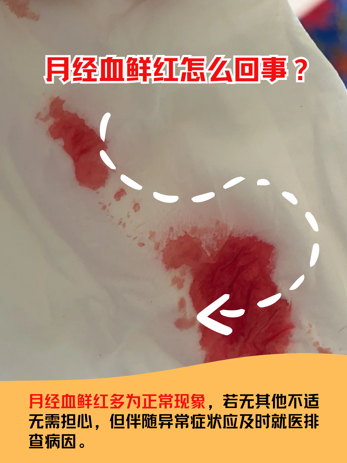 月经期喝冰的会怎样一直出血呢(月经期喝冰的会怎样一直出血吗女生怎么办)