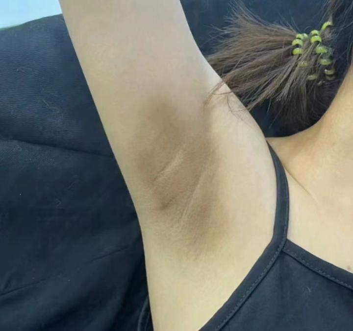 有狐臭的女孩子(有狐臭的女孩子多吗) 有狐臭的女孩子(有狐臭的女孩子多吗)