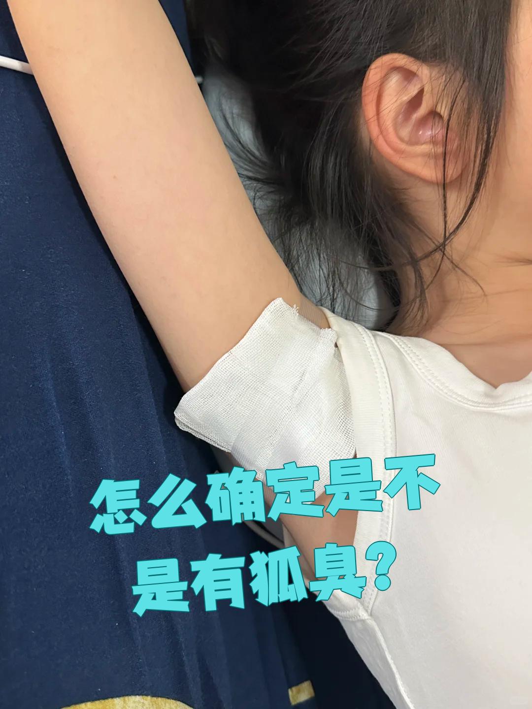有狐臭的女生能娶吗(有狐臭的女生可以结婚吗)
