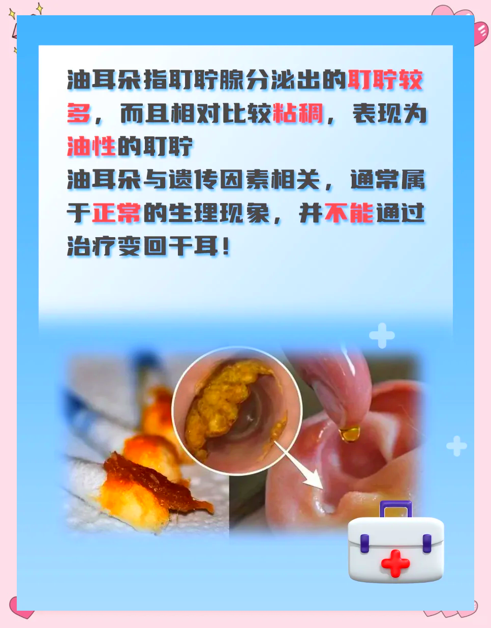 油耳型腋臭可以根治吗(油耳型腋臭如何有效治疗)