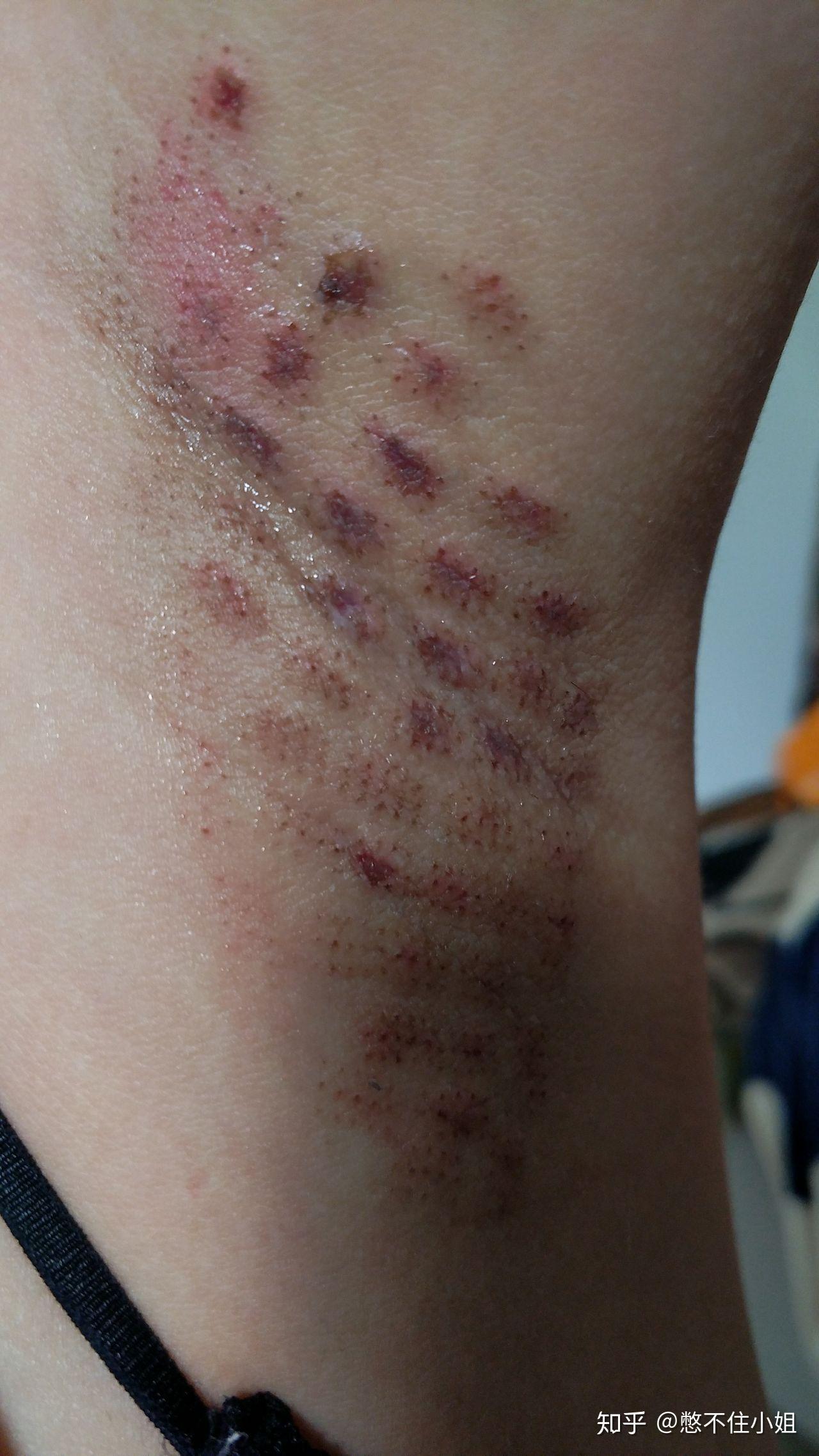 有狐臭的人命苦吗知乎(狐臭的人知道自己狐臭吗) 有狐臭的人命苦吗知乎(狐臭的人知道自己狐臭吗)
