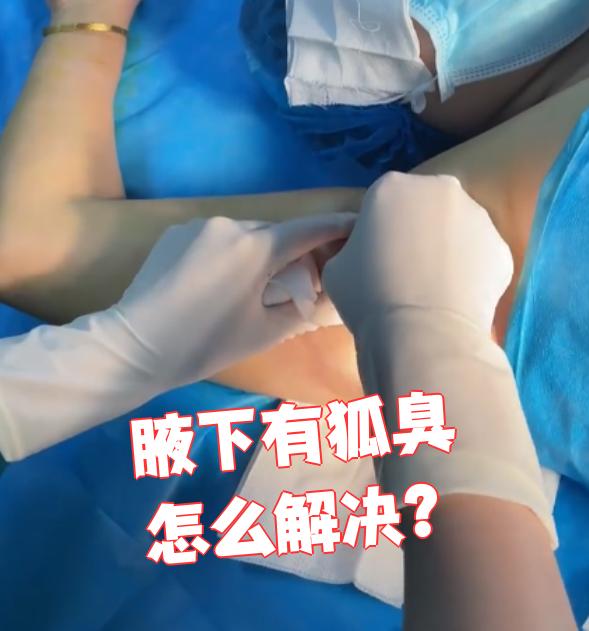 狐臭不手术要怎么处理(狐臭不手术可以根治吗) 狐臭不手术要怎么处理(狐臭不手术可以根治吗)