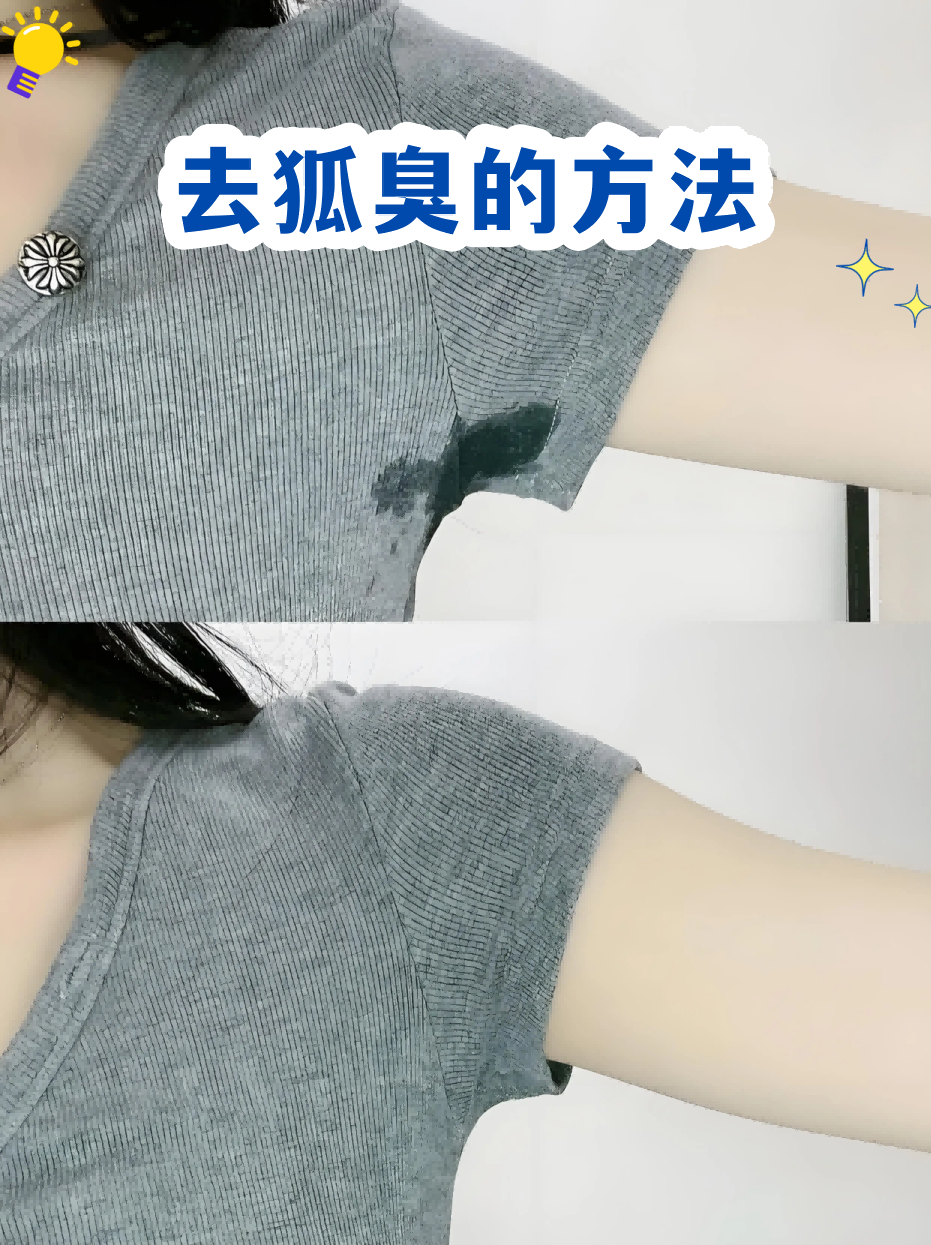 狐臭可以去当兵吗(狐臭也不能去当兵吗)