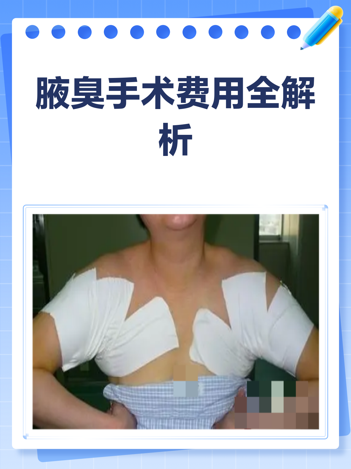 哈尔滨狐臭手术多少钱(割狐臭需要多少钱的手术费哈尔滨松北区)