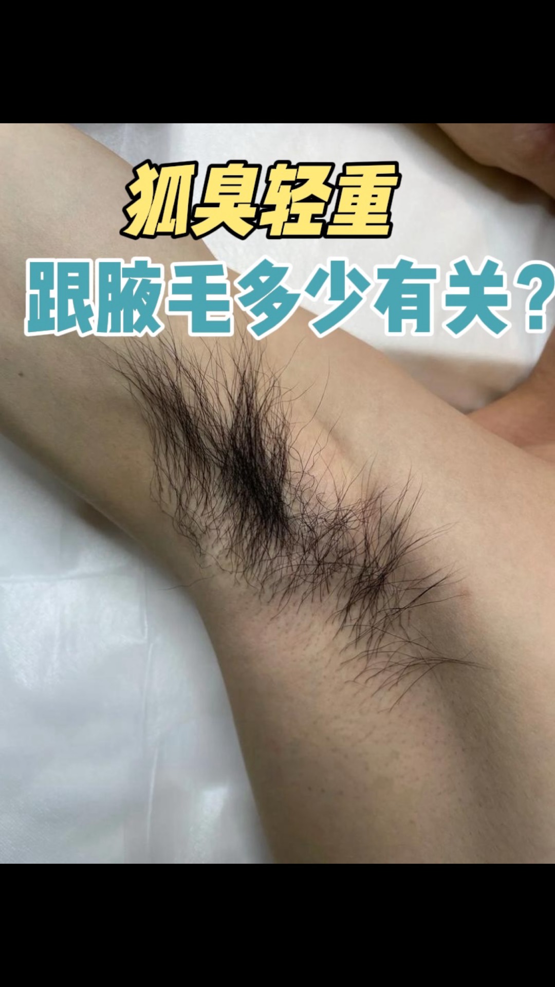 青春期假性狐臭的症状(青春期假性狐臭和狐臭的区别)
