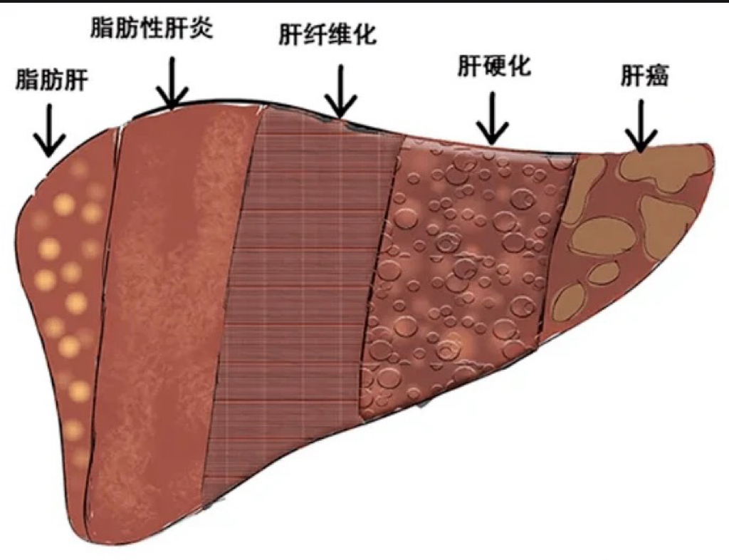 乙肝患者可以吃茄子吗女性怀孕(乙肝患者可以吃茄子吗女性怀孕有影响吗)