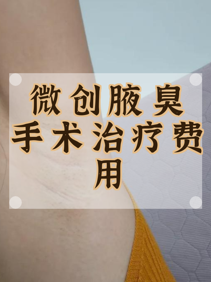 狐臭手术费用贵吗(狐臭手术费用贵吗多少钱)