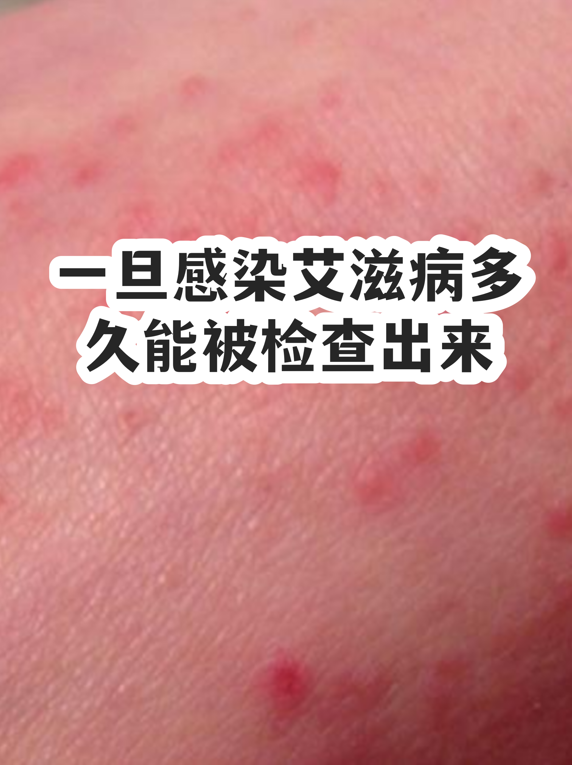 艾滋病第四代检测多久能结果(艾滋病第四代检测第四周准确吗)