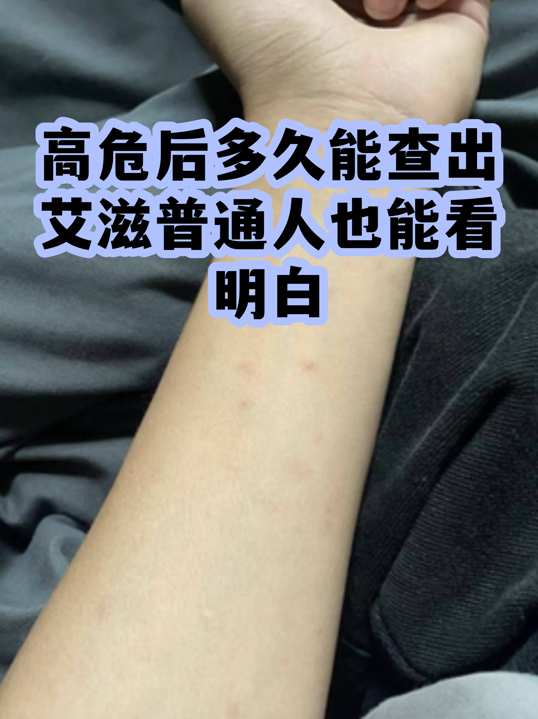 艾滋病第四代检测多久能结果(艾滋病第四代检测第四周准确吗) 艾滋病第四代检测多久能结果(艾滋病第四代检测第四周准确吗)