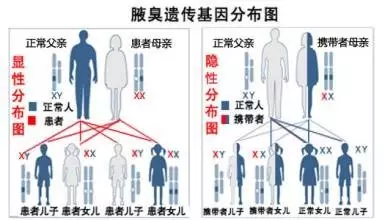 狐臭会不会遗传给下一代(遗传性狐臭怎么不遗传给下一代) 狐臭会不会遗传给下一代(遗传性狐臭怎么不遗传给下一代)