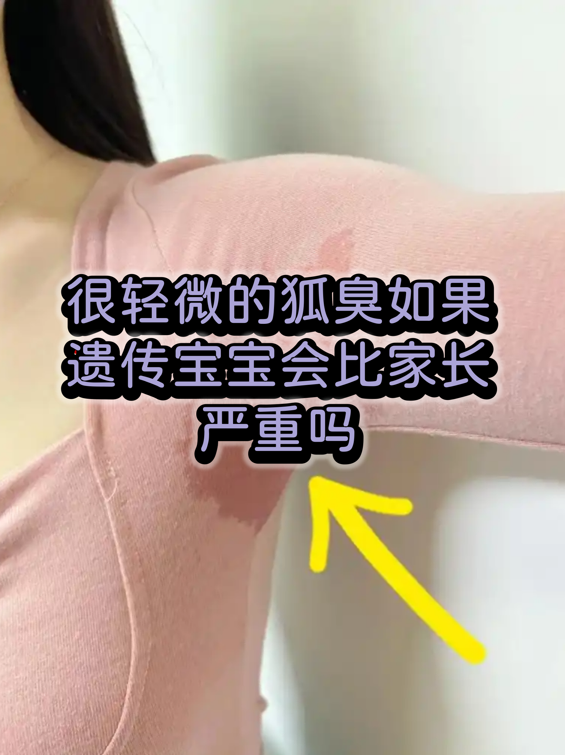 狐臭对当兵有影响吗(有狐臭影响当兵吗男生)