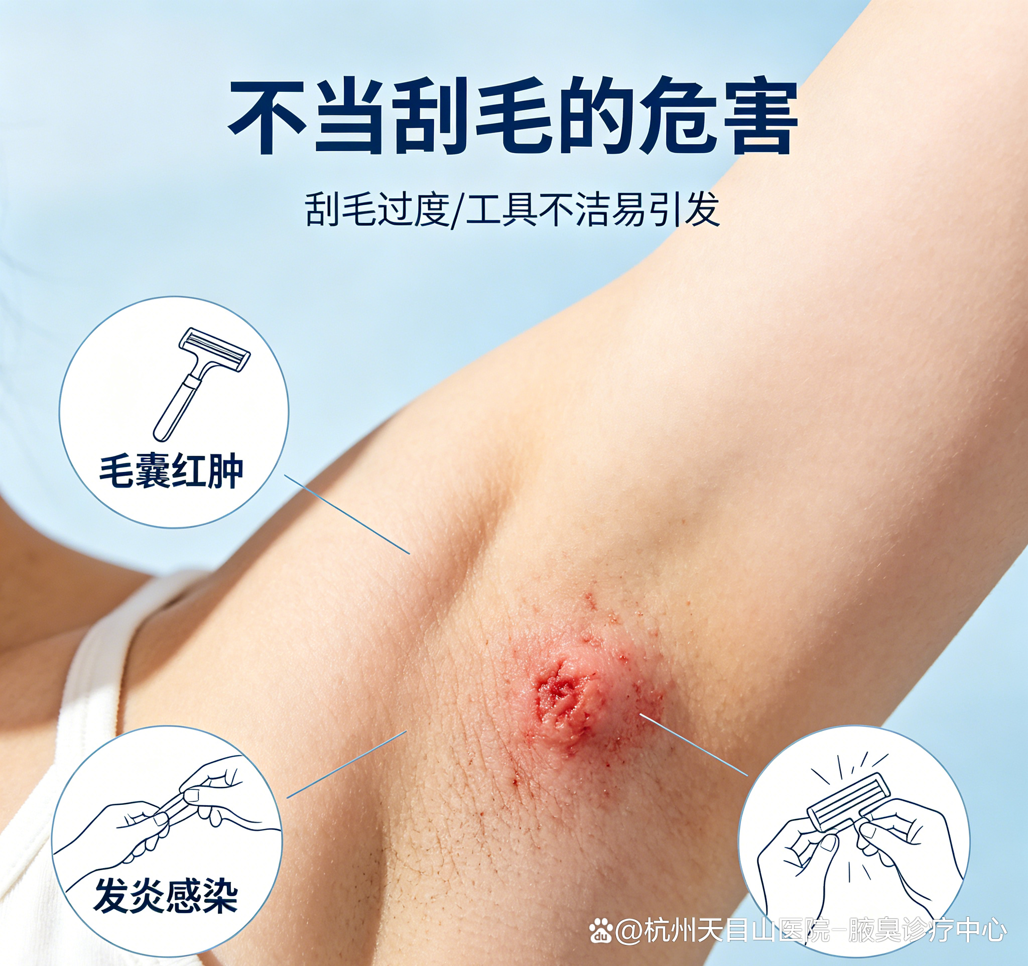 狐臭会不会变严重(狐臭会不会遗传给下一代)