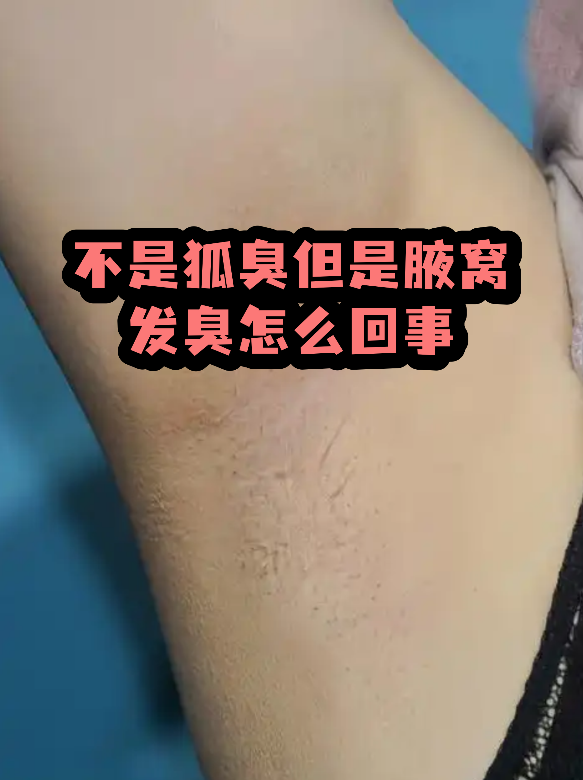 狐臭对身边的人有影响吗(狐臭对身边的人有影响吗怎么治疗) 狐臭对身边的人有影响吗(狐臭对身边的人有影响吗怎么治疗)
