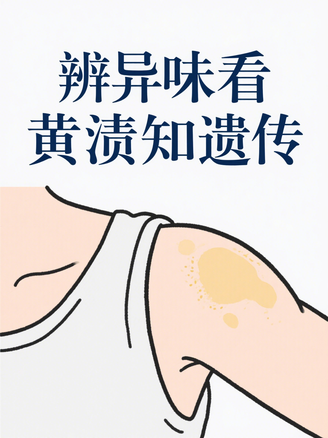 怎么区分狐臭和腋臭传染吗(怎么区分狐臭和腋臭传染吗图片) 怎么区分狐臭和腋臭传染吗(怎么区分狐臭和腋臭传染吗图片)