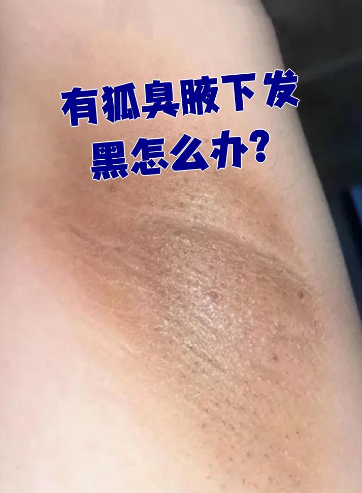 有狐臭的女人身体那里不好怎么办(有狐臭的女人身体那里不好怎么办?)