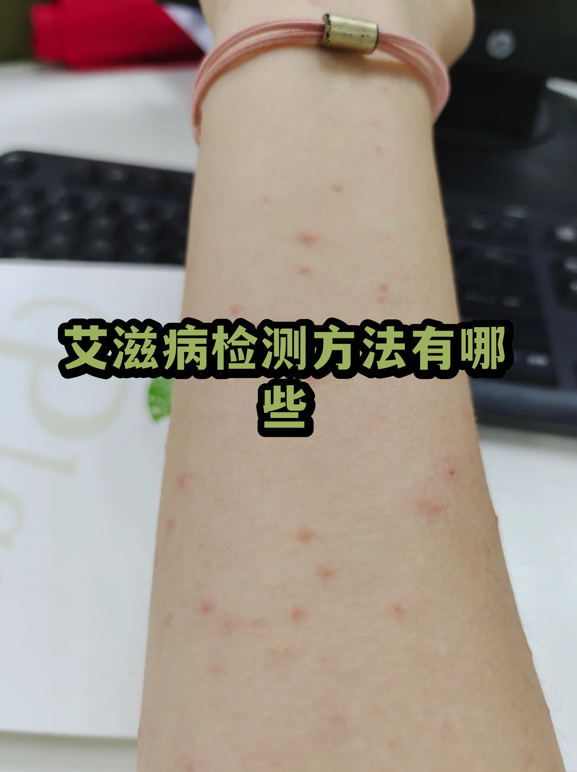 艾滋病第四代检测方法多久排除(艾滋病第四代检测方法多久排除?) 艾滋病第四代检测方法多久排除(艾滋病第四代检测方法多久排除?)