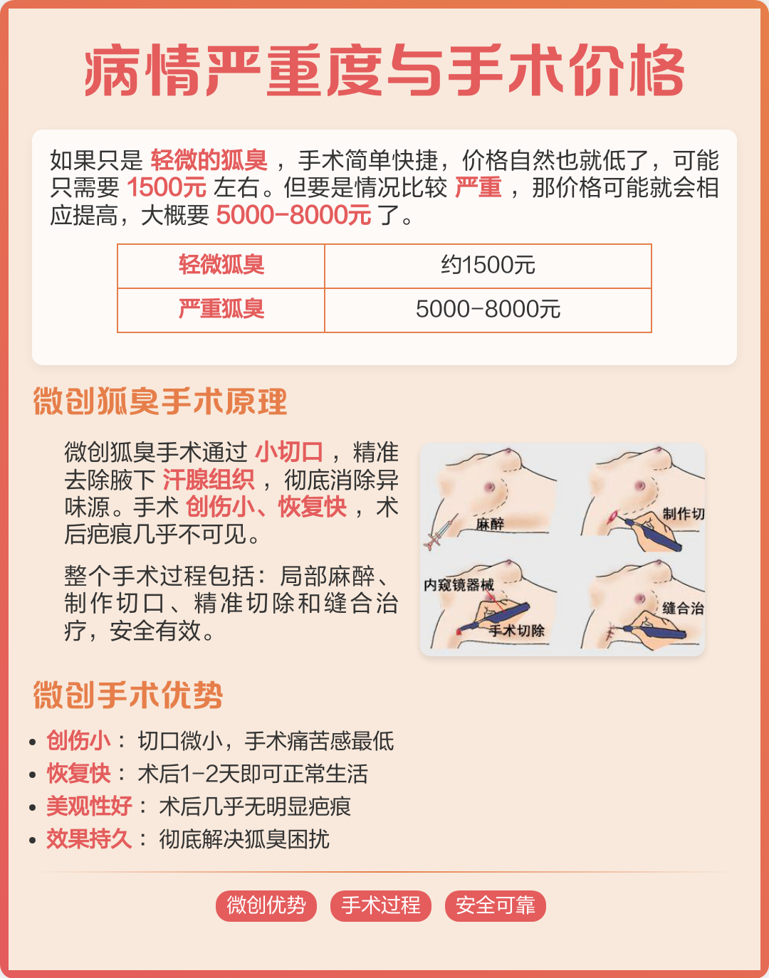 狐臭手术纳入医保吗(狐臭手术纳入医保吗多少钱)